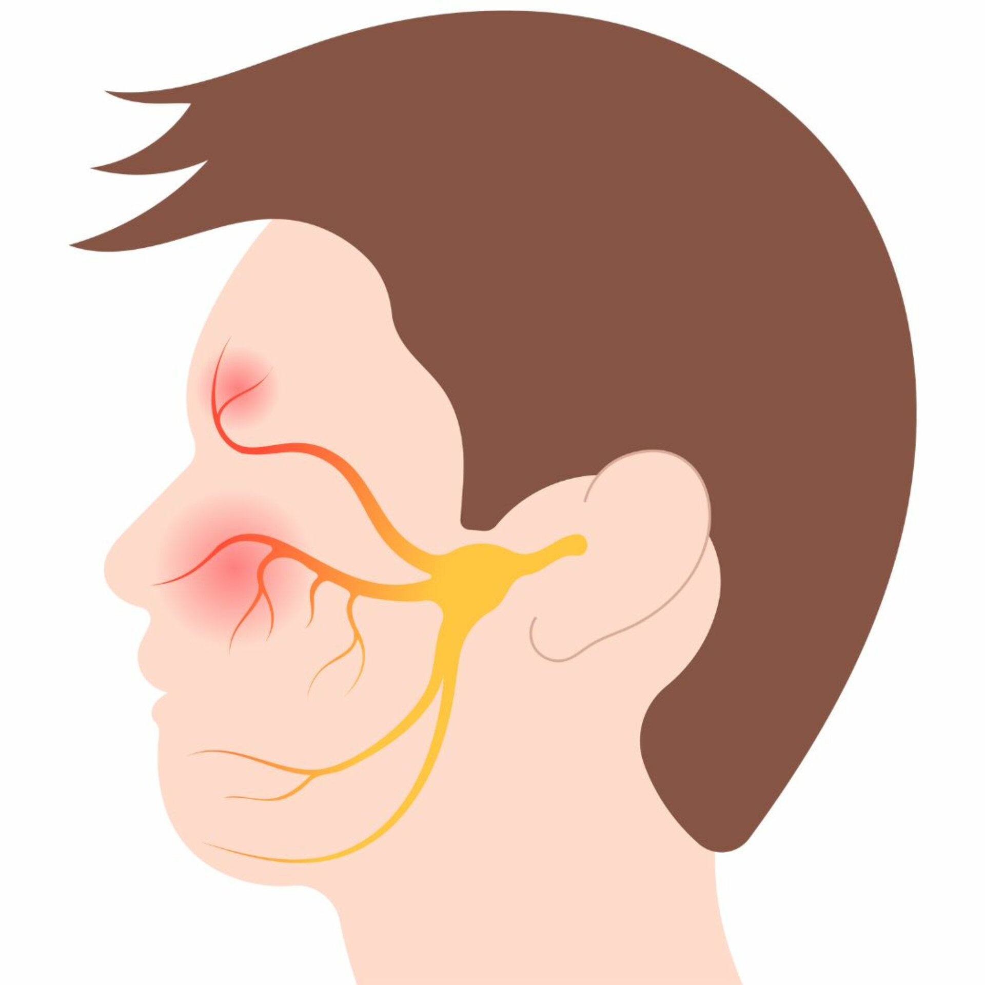 Stroke and Bell’s palsy treatment
